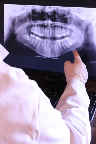 Best Emergency Cosmetic Dentistry in Spanay, WA